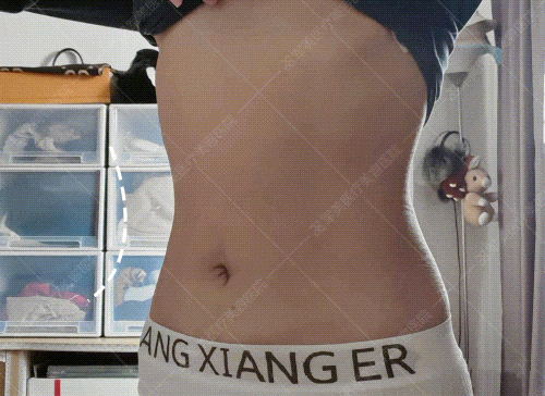 广州腰腹吸脂多少钱