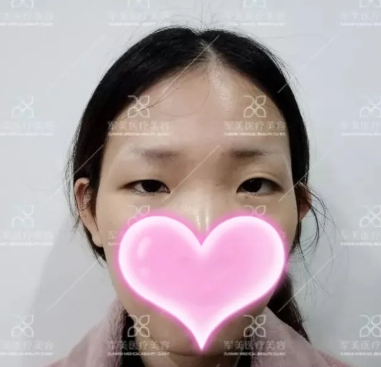 大小眼怎么解决