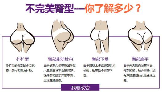 自体脂肪丰臀存活率高吗