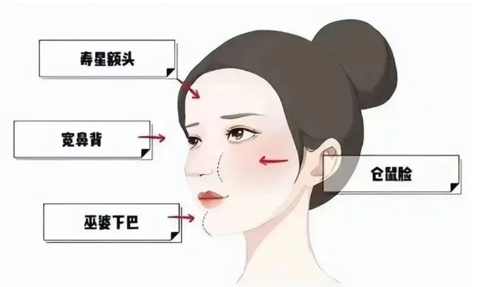 自体脂肪填充医院推荐