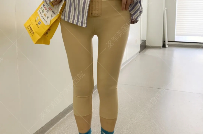 吸脂术后塑身衣要穿多久