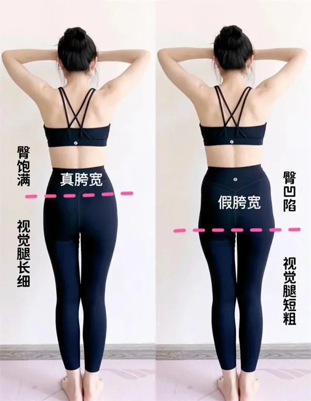 大腿吸脂哪家医院好