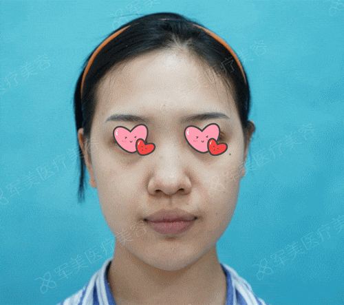 广州鼻子整形医院排名