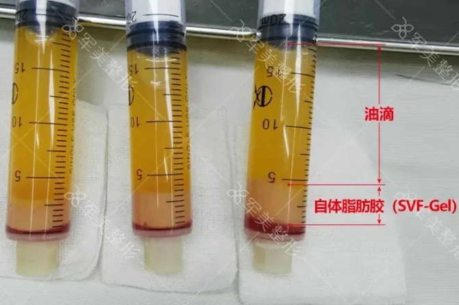 如何改善黑眼圈