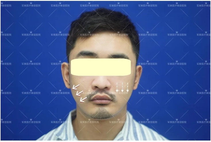 如何抗衰老保持青春