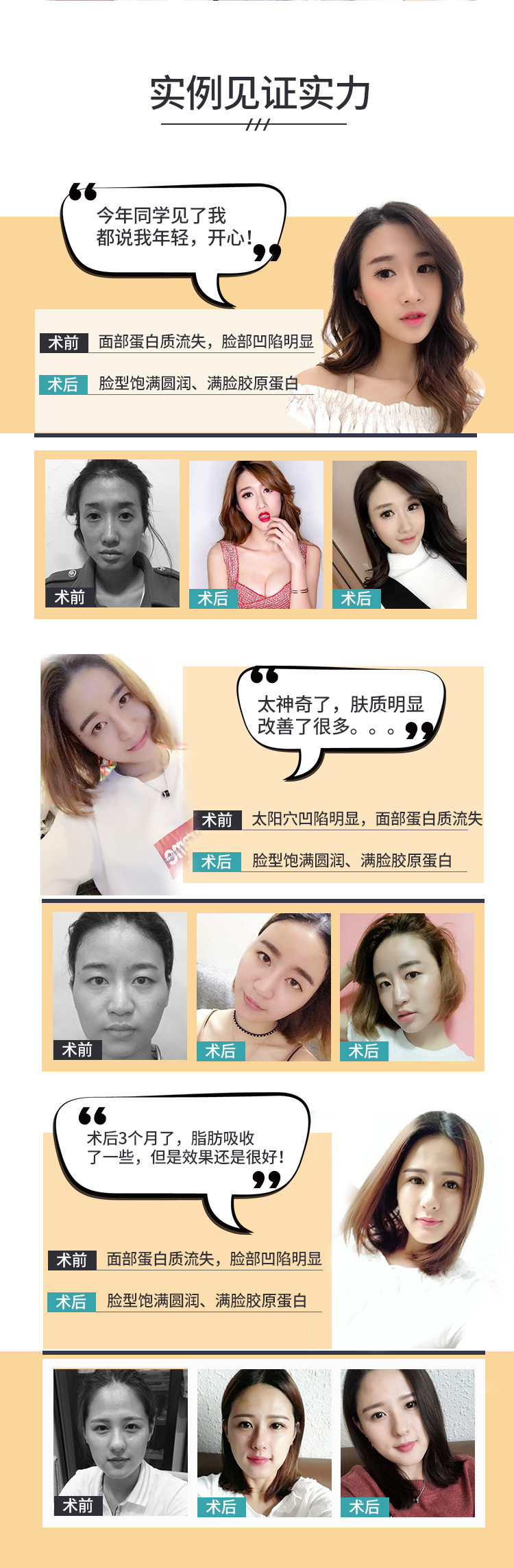 自体脂肪填充会馒化吗