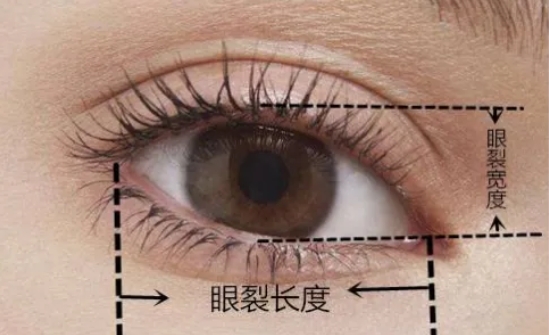 眼睛小割双眼皮能变大吗