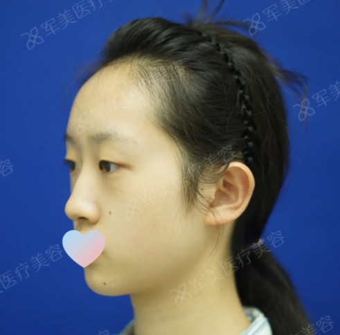 眼鼻综合案例