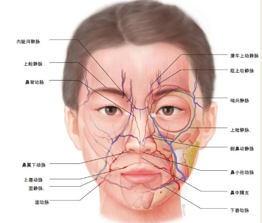 木偶纹永久去除医美方法