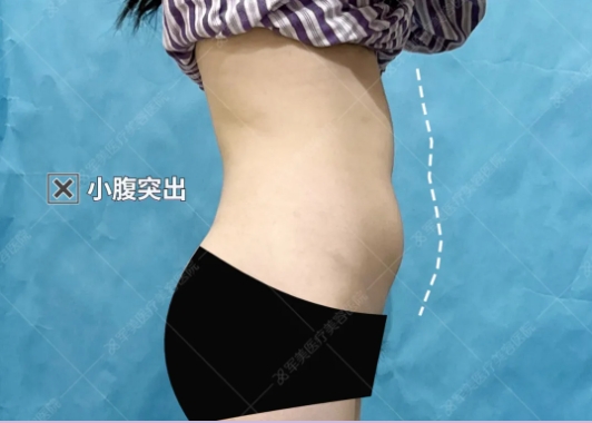 瘦腰腹最好的办法