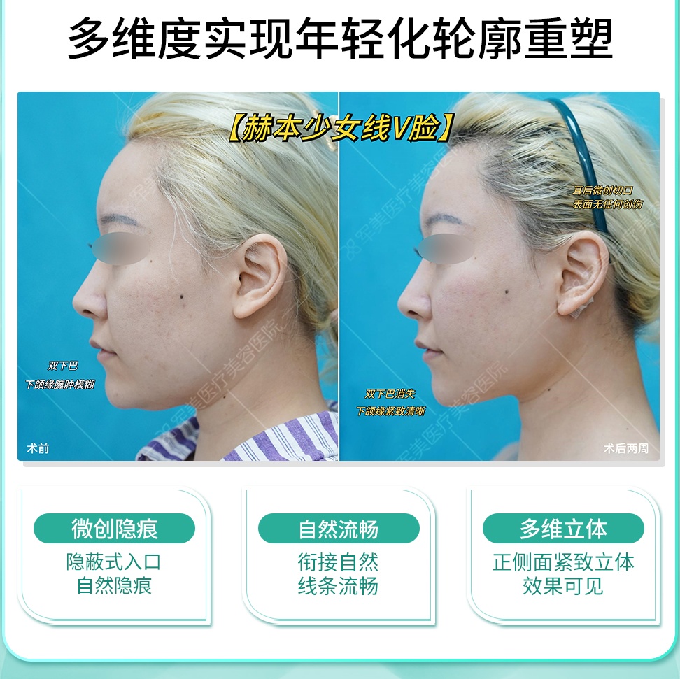 抗衰秘籍大公开！轻松拿捏冻龄肌