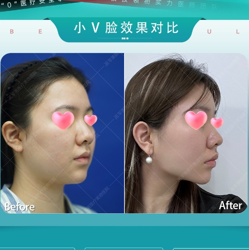 40多岁的女人如何抗衰？40+冻龄秘籍大公开
