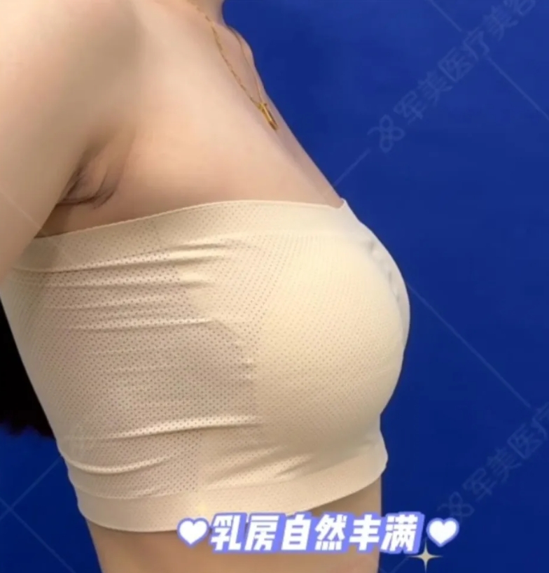 王世虎脂肪丰胸