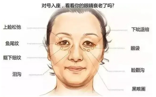 眼部问题有哪些