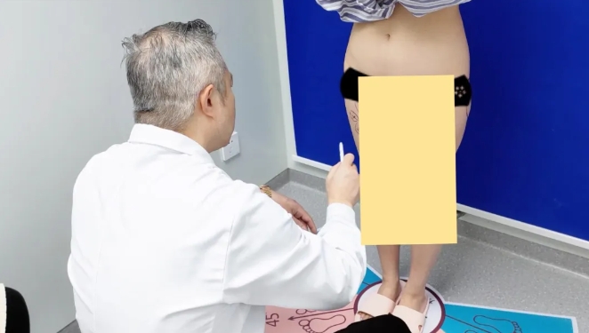 大腿吸脂失败修复医生