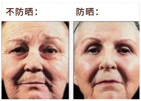 衰老的快原因是不防晒