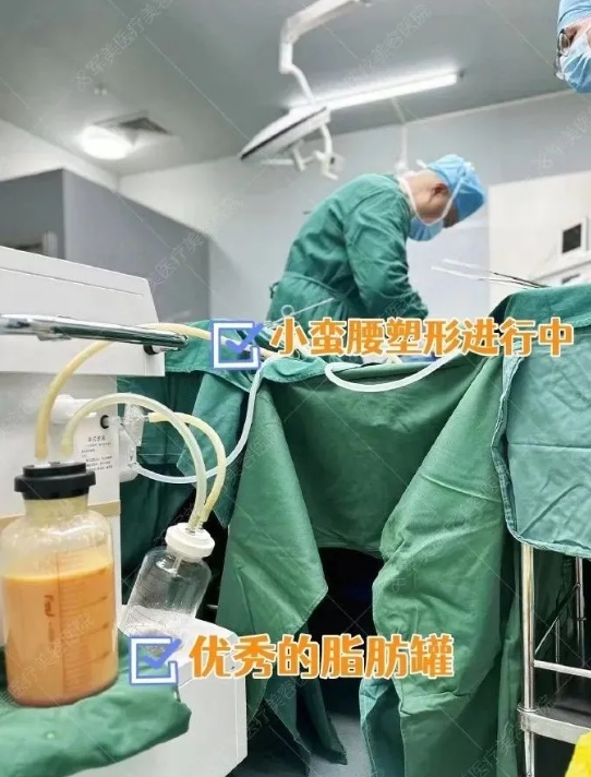 王世虎腰腹环吸案例
