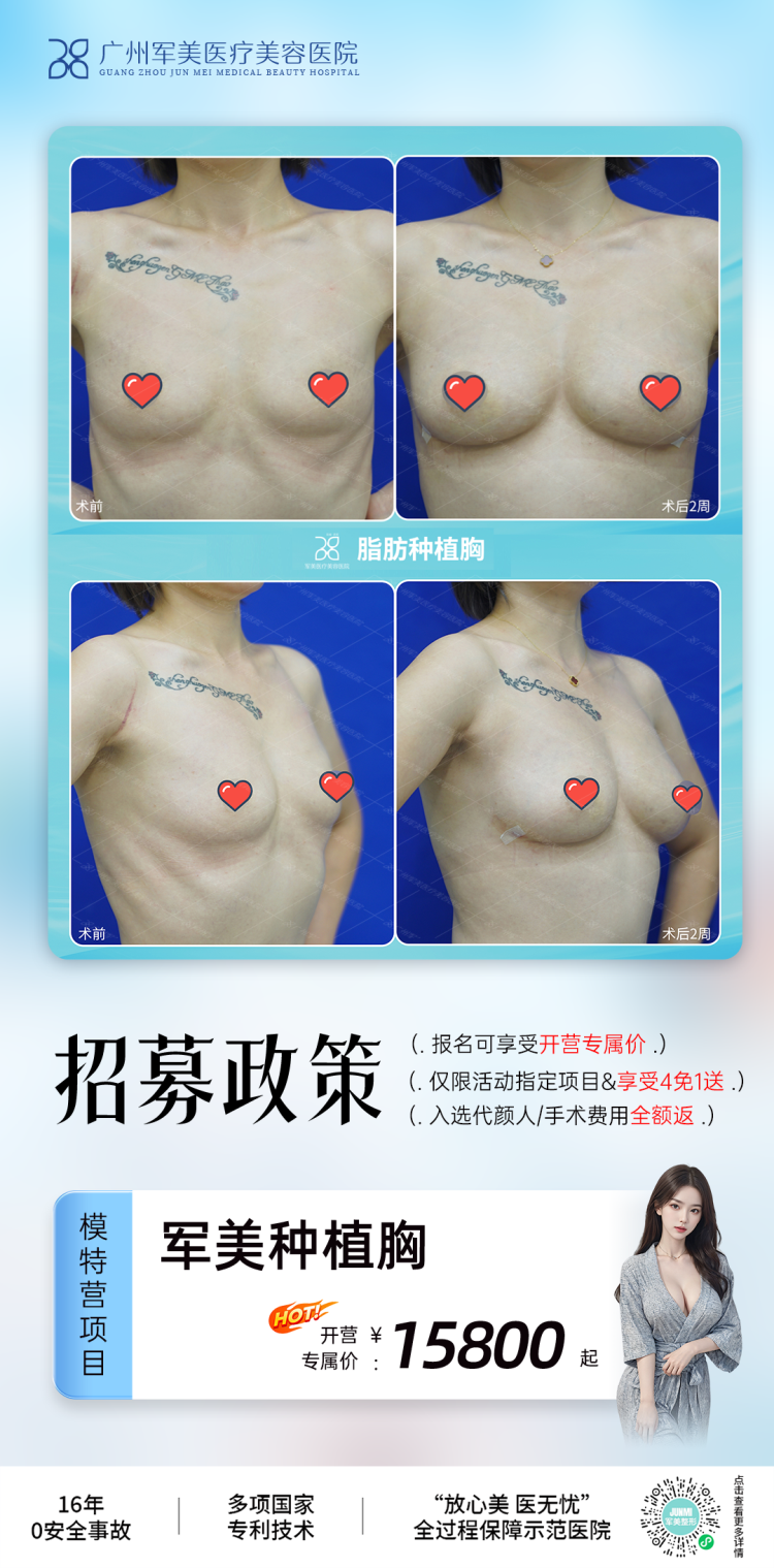王世虎吸脂价格表