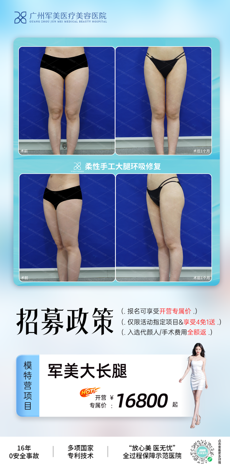 王世虎脂肪隆胸价格