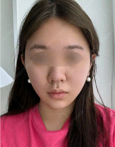 抗衰老的医美项目
