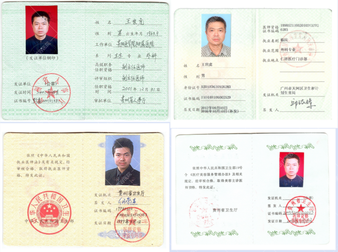 王世虎吸脂怎么样