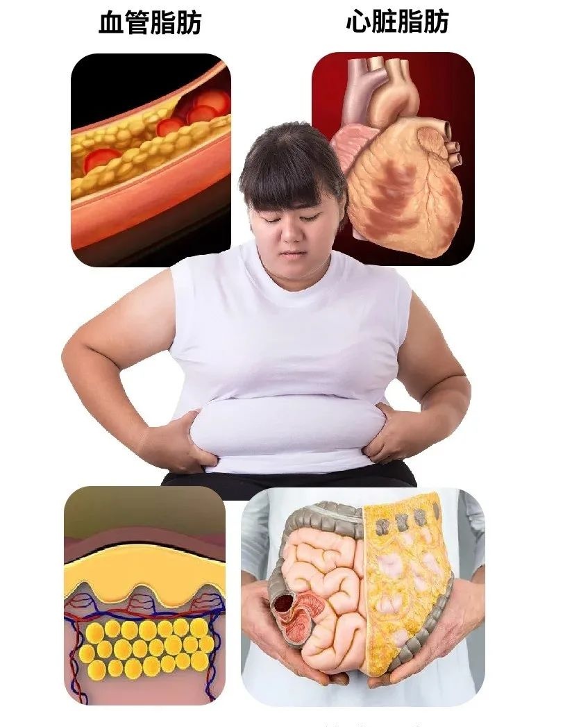 腹部脂肪为什么难减