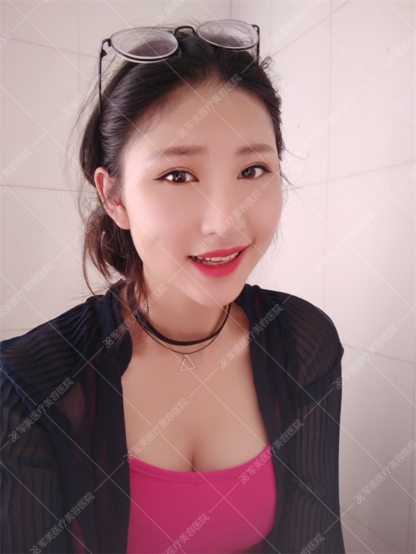 广州军美王娜案例