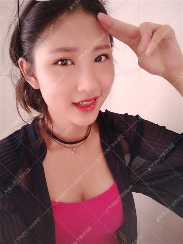 广州军美王娜案例