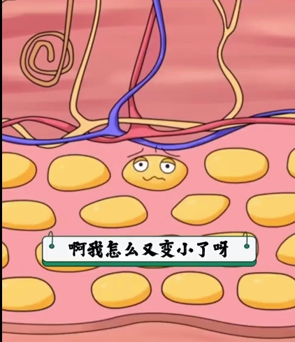 吸脂过程演示图