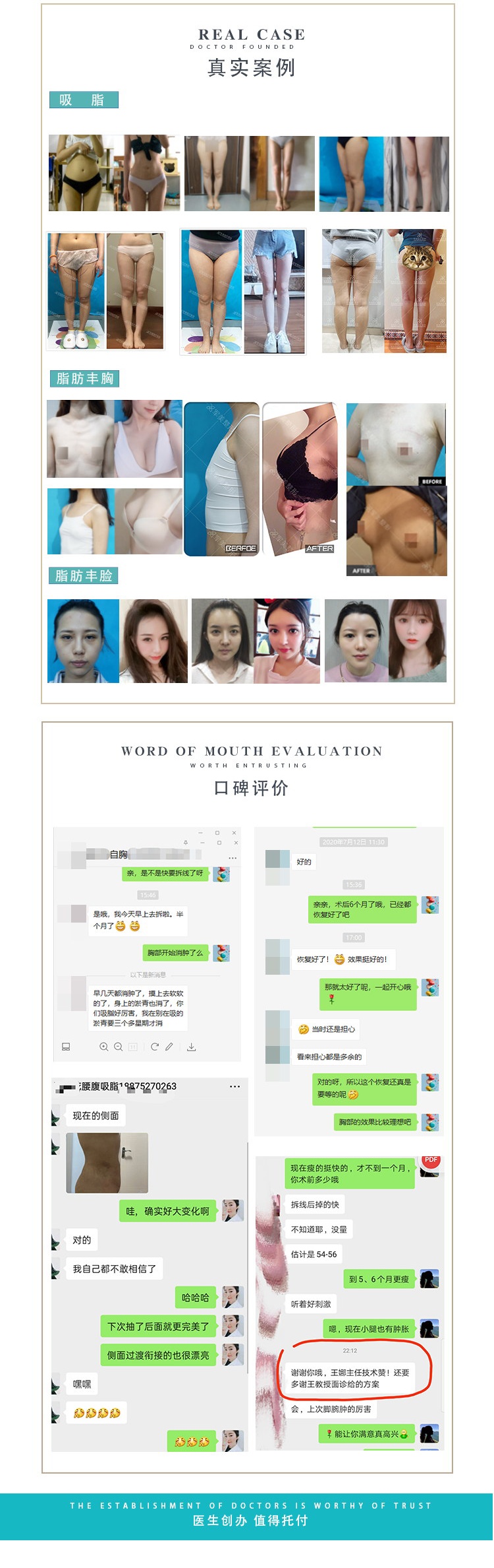 王世虎吸脂案例