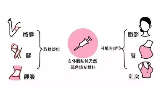 王世虎面部脂肪填充案例