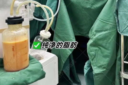 吸脂怎么找合适的医生
