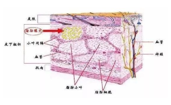 自体脂肪填充