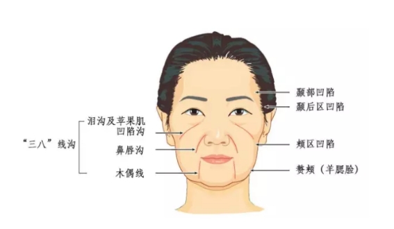 法令纹怎么消除最好最有效