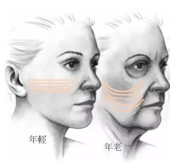 法令纹怎么消除最好最有效
