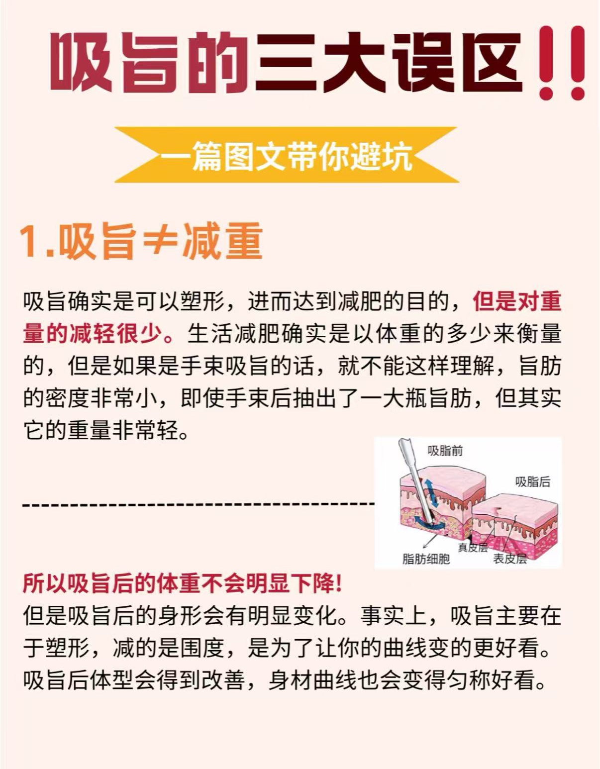 吸脂能瘦多少斤图示