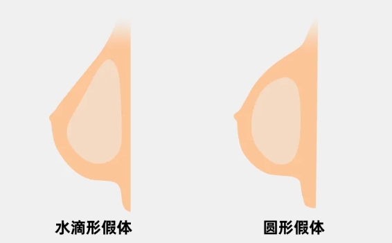 假体隆胸和自体脂肪隆胸哪个更好