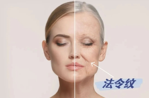 法令纹怎么改善消除