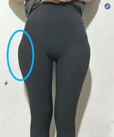 假胯宽能抽脂吗抽掉吗