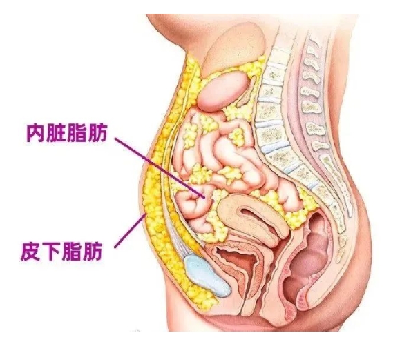 什么是吸脂手术