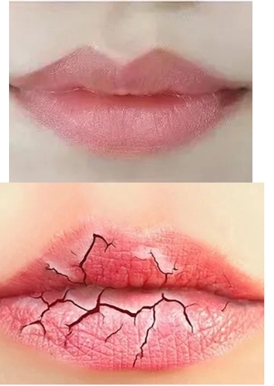 唇部衰老怎么改善