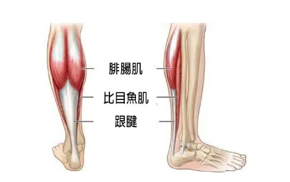 瘦腿最有效的办法