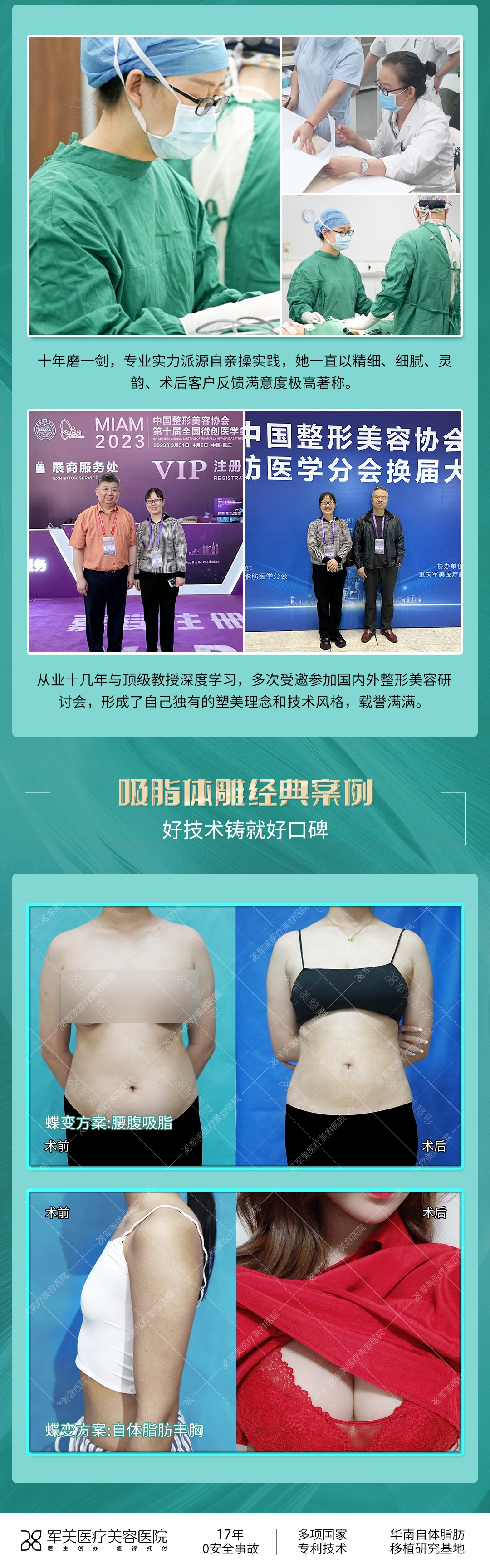 广州军美王娜脂肪填充怎么样