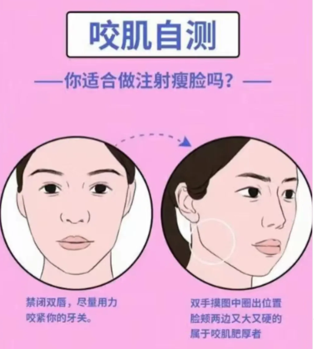 什么人瘦脸针不能打