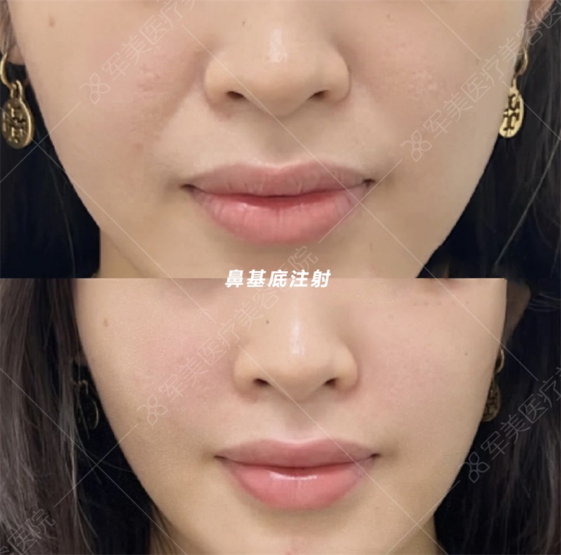 皮肤美容项目有哪些