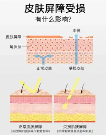 皮肤美容项目有哪些