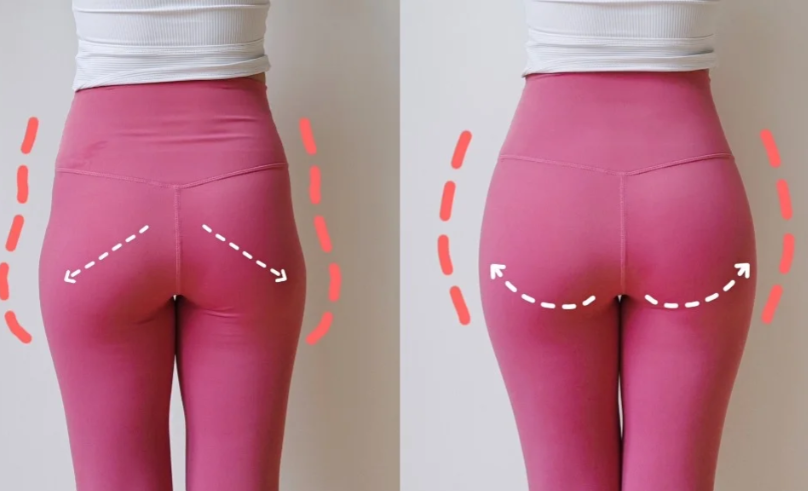 妈妈臀两侧赘肉怎么减