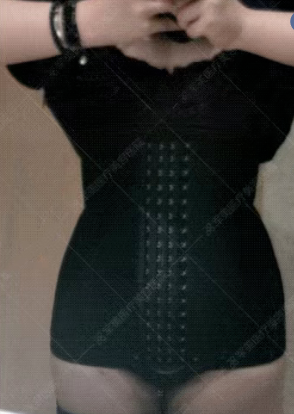 腰腹吸脂哪家医院好