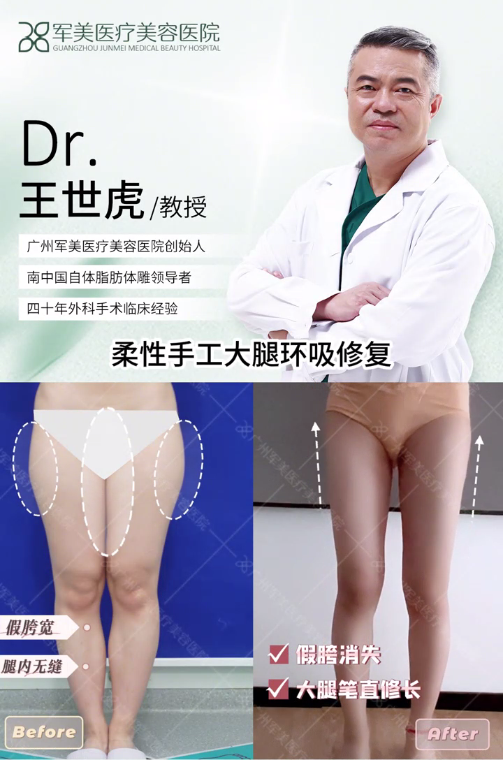 吸脂修复哪里最好