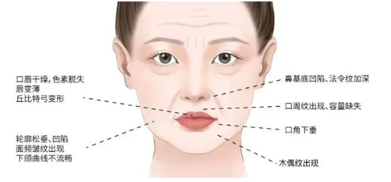 口周老化做什么项目